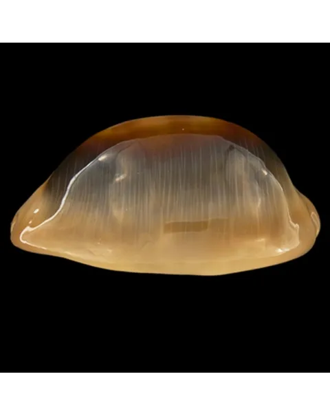 Lyncina Ventriculus