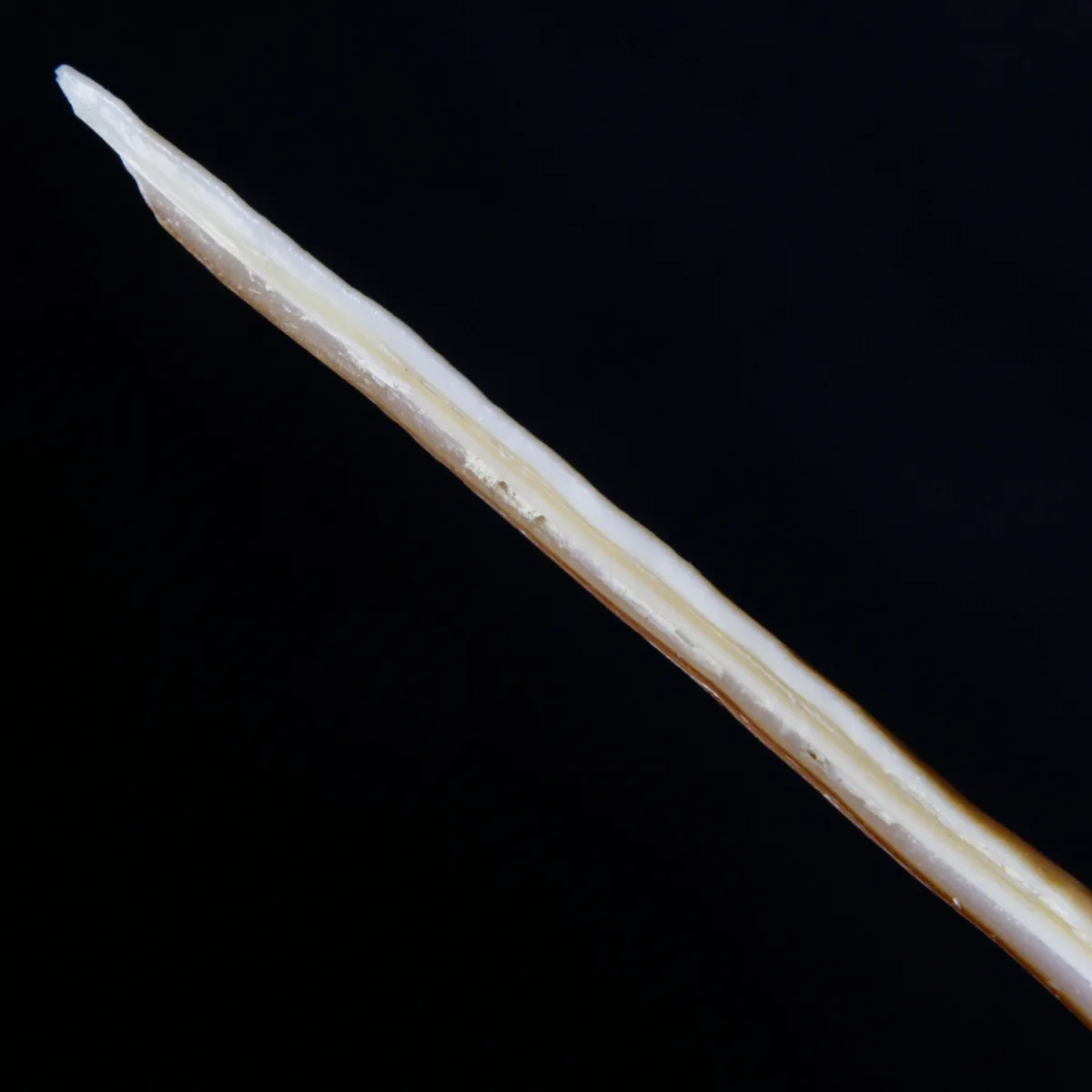 Tibia Fusus